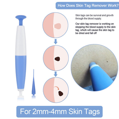Skin Tag Removal Kit Home Use Mole Wart Remover Micro Band Skin Tag Treatment Tool Easy To Clean Skin Care Tool